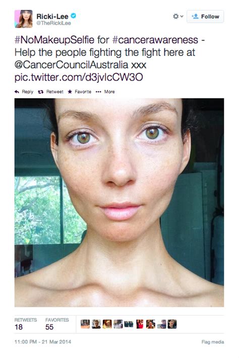 Breast Cancer Donations Soar With Viral No Make Up ‘selfies Starts At 60