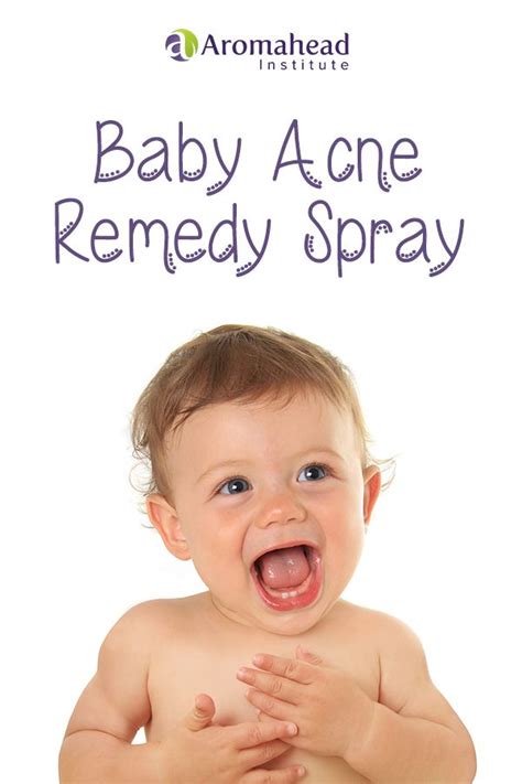 Lets Make An All Natural Baby Acne Remedy This Baby Acne Remedy Is As