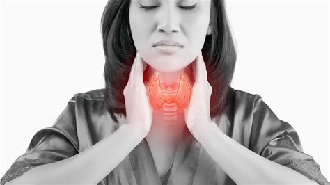 Hypothyroidism Signs Symptoms And Treatment Ask The Doctor