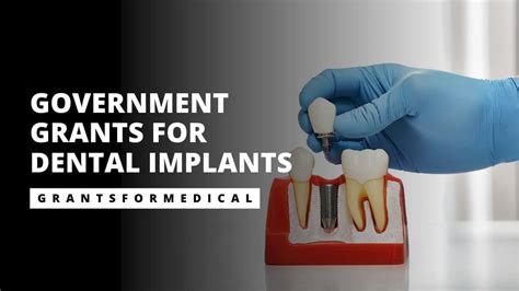 Government Grants For Dental Implants Free Dental Implants