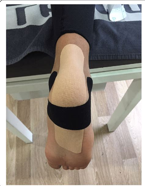 Kinesio Taping Treatment Applied To The Achilles Tendon And Heel Region