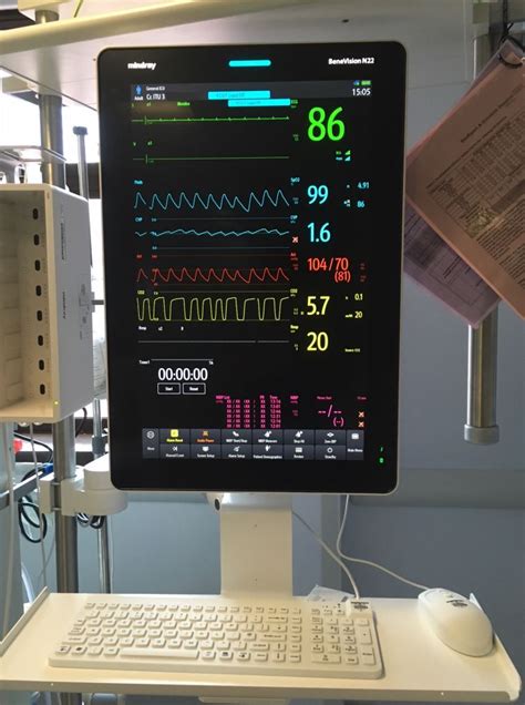 Cardiac Monitor Icu Knowledge