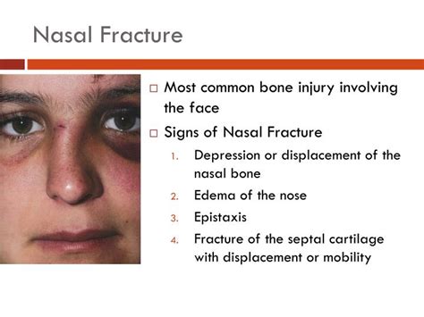 PPT - TRAUMA PowerPoint Presentation - ID:2392451