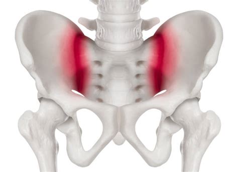 280 Sacroiliac Joint Stock Photos Pictures And Royalty Free Images Istock