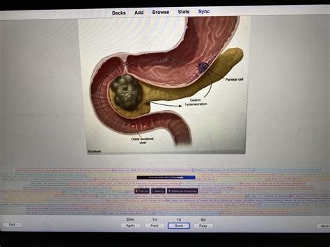 How to clean up tags Anking V11 : r/medicalschoolanki