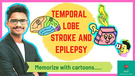 Temporal Lobe Stroke Features Epilepsy Features Animation Cns Integrated Next Based