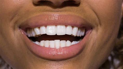 The army was armed to the teeth and ready to defend their positions against any form of attack. Strong, white teeth good for self-esteem, health | The ...