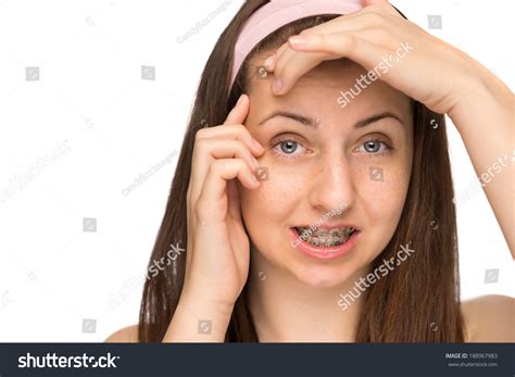 Worried Girl Braces Squeezing Pimple Teenager ภาพสต็อก 188967983 Shutterstock