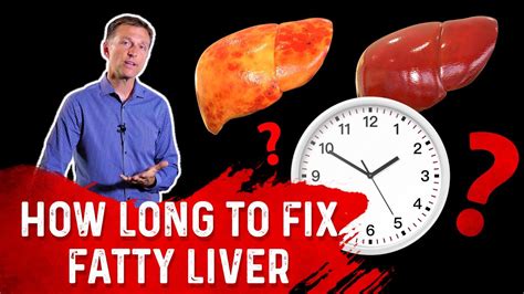 How Long Does It Take To Fix Fatty Liver Dr Berg