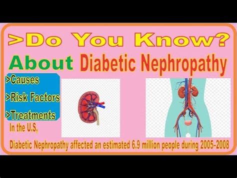 Diabetic Nephropathy Explained Easy Health Tips Dr Sheen YouTube