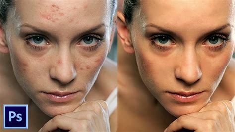 Skin Retouching Photoshop Tutorial Professional Skin Retouching In Under Mins Youtube