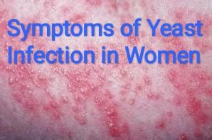 Symptoms Of Yeast Infection In Women