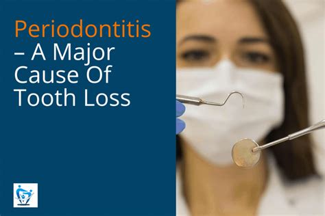Periodontitis A Major Cause Of Tooth Loss Your Healthy Smile