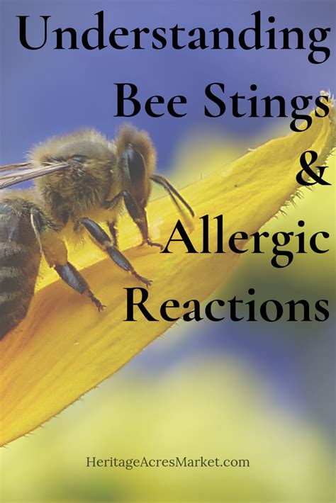 Understanding Bee Stings Allergic Reactions Artofit