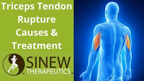 Triceps Tendon Rupture Causes And Treatment Youtube