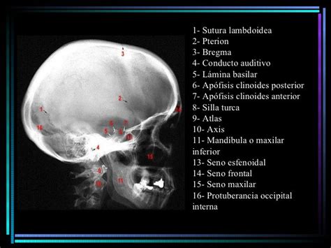 radiografia lateral de cabeza Radiografia de craneo Anatomía de la cabeza Estudiante de