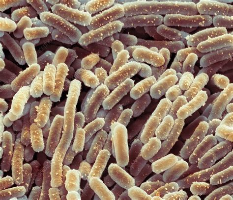 Lactobacillus Bacteria Sem Stock Image C0207284 Science Photo