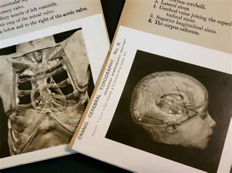 Original Antique Medical Stereoview Cards Vintage Medical Anatomy