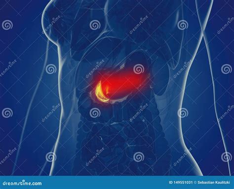 A Womans Pancreas Stock Illustration Illustration Of Pancreatitis