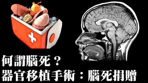 Be the first person to like this page among your friends! 什麼是腦死？器官捐贈手術：腦死捐贈｜許原彰醫師 - YouTube