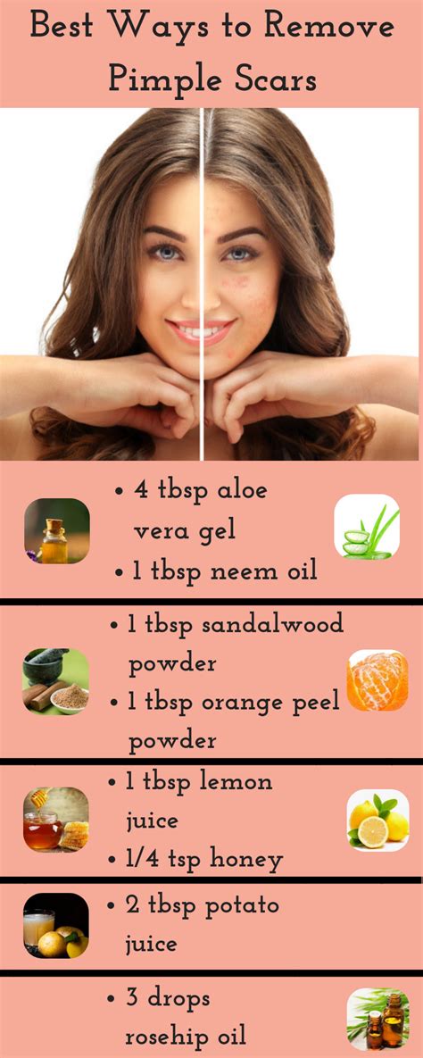How To Remove Your Acne Scars Naturally Howotremvo