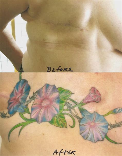 Tatuajes de cirugía mamaria Cerebro del blog