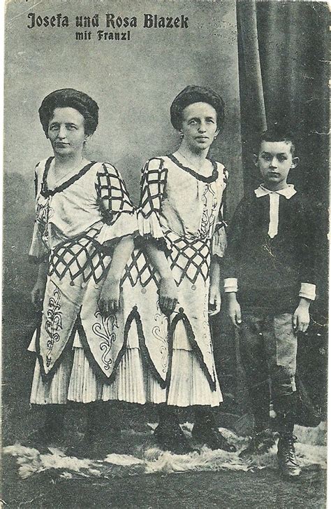 German Siamese Twins And Brotherearly 20thmy Vault Human Oddities