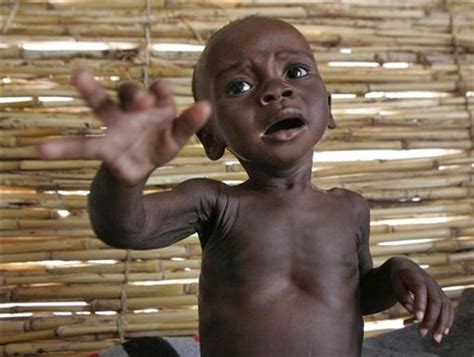 Famine In Niger Photo 4 Cbs News