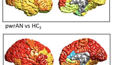 Groundbreaking Study Shows Substantial Differences In Brain Structure