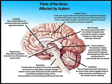 Part Of The Brain Affected By Asd What Is Autism Cognitive Enhancement
