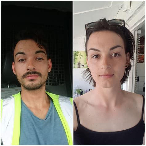 28 Yo 2 Months Pre Hrt 17 Months Hrt Rtranstimelines