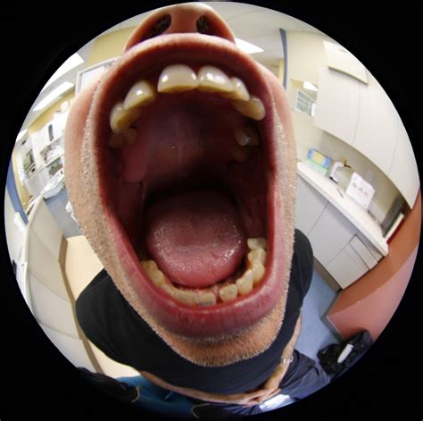 What Does Your Uvula Do Wonderopolis