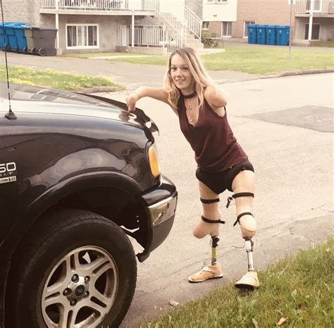Love For Limbless Women — Legless Cripple Showing How She Crawls On The Wheelchair Women