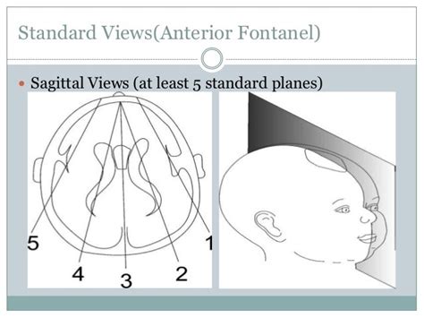 Neonatal Head Ultrasound New Health Advisor