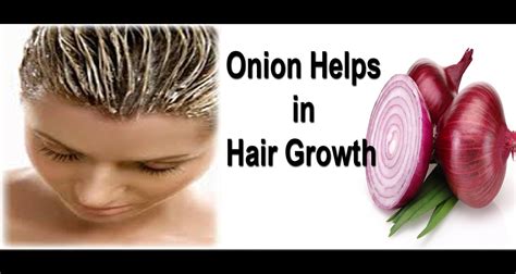 Onion For Hair Loss Hair Thinning And Hair Re Growth Beauty And