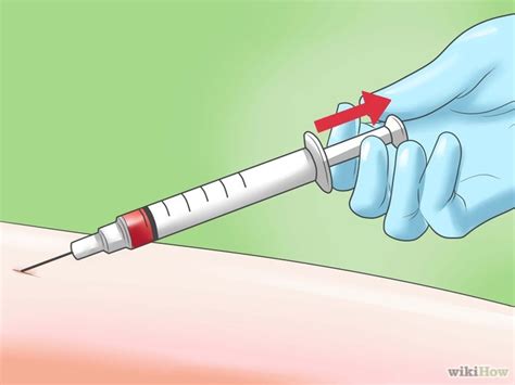 Cara Melakukan Injeksi ~ Ilmu Kesehatan