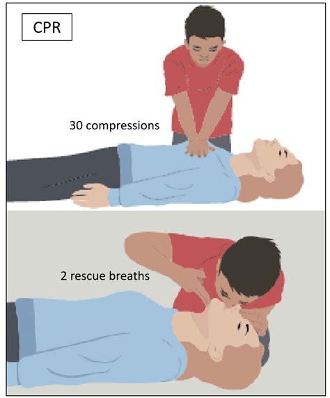 Cpr Steps For Giving