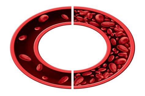 10 causes of anemia understanding the underlying factors