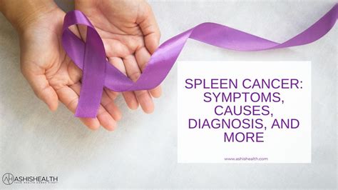 Spleen Cancer Causes Diagnosis Symptoms And Treatment