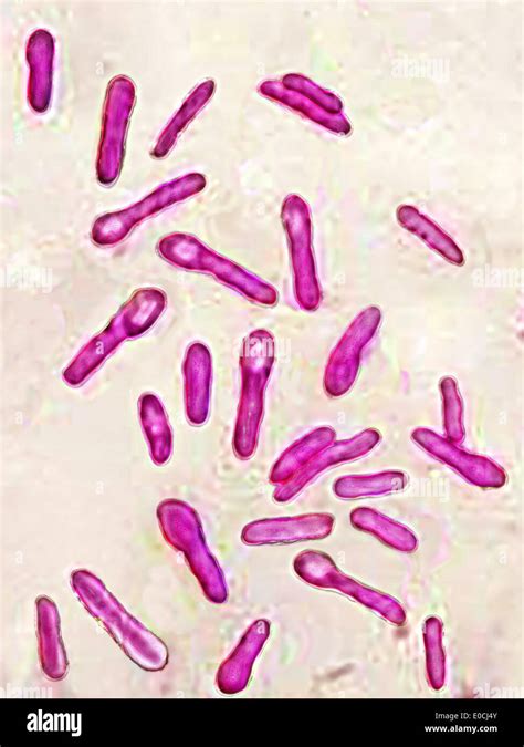 Clostridium Botulinum Structure
