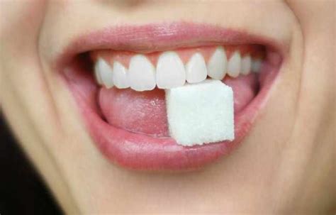 does sugar really cause cavities 3v dental associates