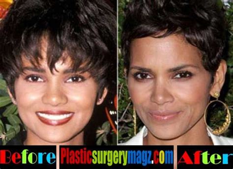 Halle Berrys Stunning Transformation Before And After Nose Job