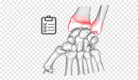 Thumb Elbow Bone Ulnar Nerve Joint Stale Hand Human Png PNGEgg
