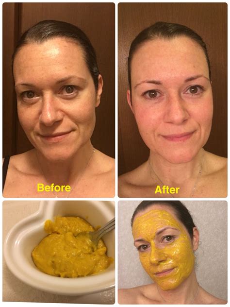 Turmeric Powder For Hair Removal 125 Best Haircuts In 2020