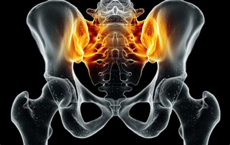 Mri Lesion Combinations In The Sacroiliac Joint Improve Diagnosis Of