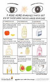 Photos of Home Remedies Bags Under Eyes Dark Circles