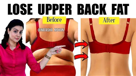 1 Minute To Reduce Upper Back Fat Bra Bulge Permanently Easy No