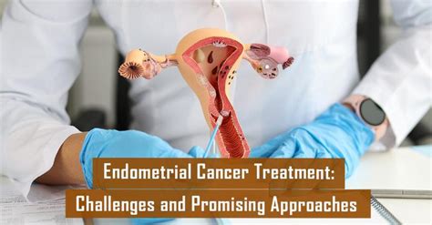 Pembrolizumab Plus Chemotherapy In Advanced Endometrial Cancer