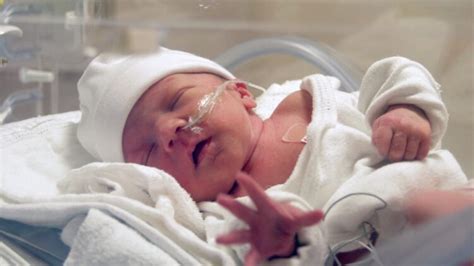 5 Penyakit Pada Bayi Prematur Ketahui Tanda Tanda Dan Pencegahan