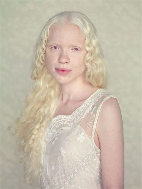 Albino People Wholl Mesmerize You With Their Otherworldly Beauty Albino Girl Portrait